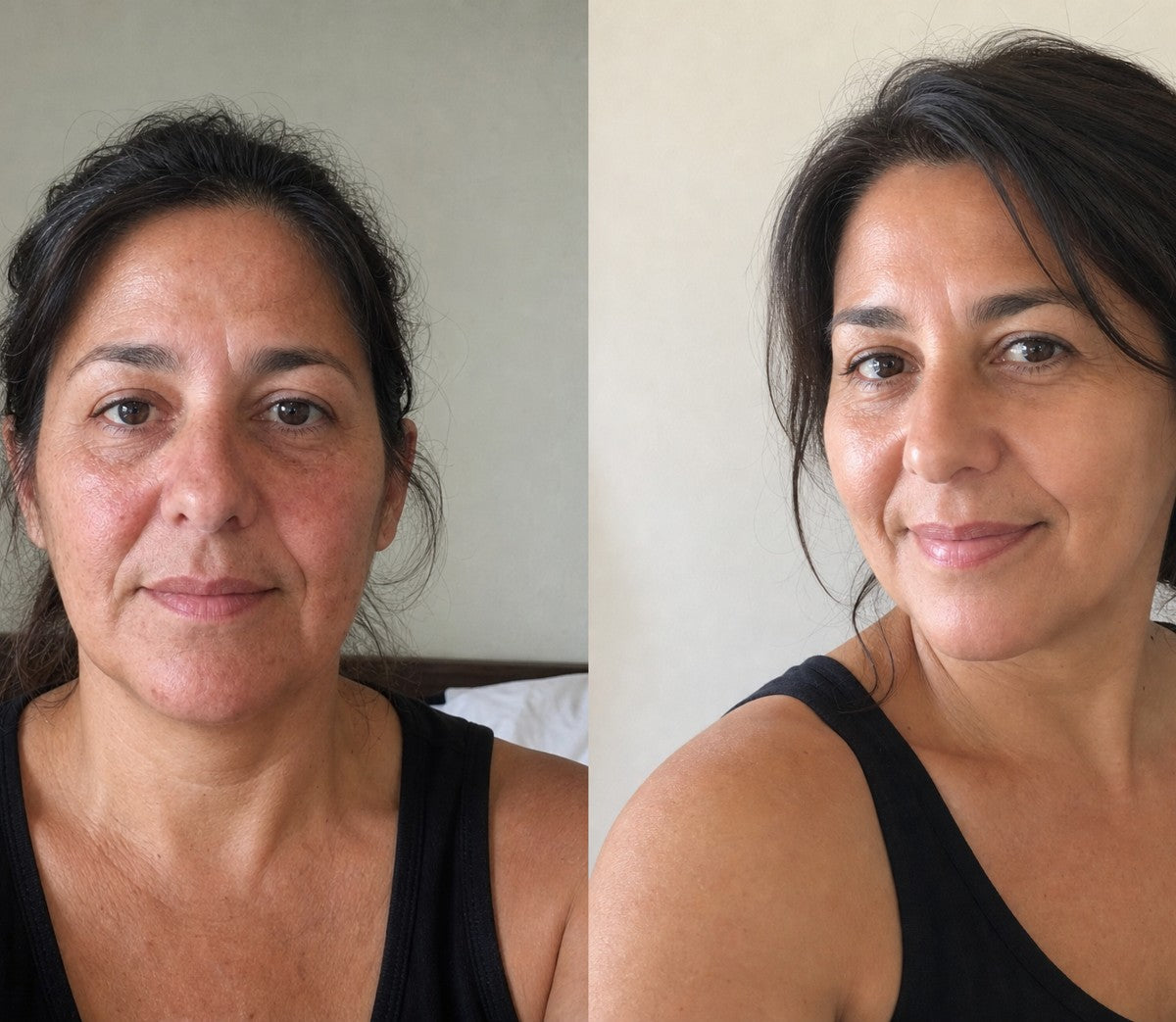 Michele before and after