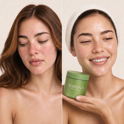 Before and after: clearer skin holding Bubble Mask Clay