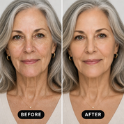 Before and after — mature skin