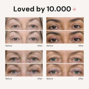Loved by 10.000+ — before and after on four women
