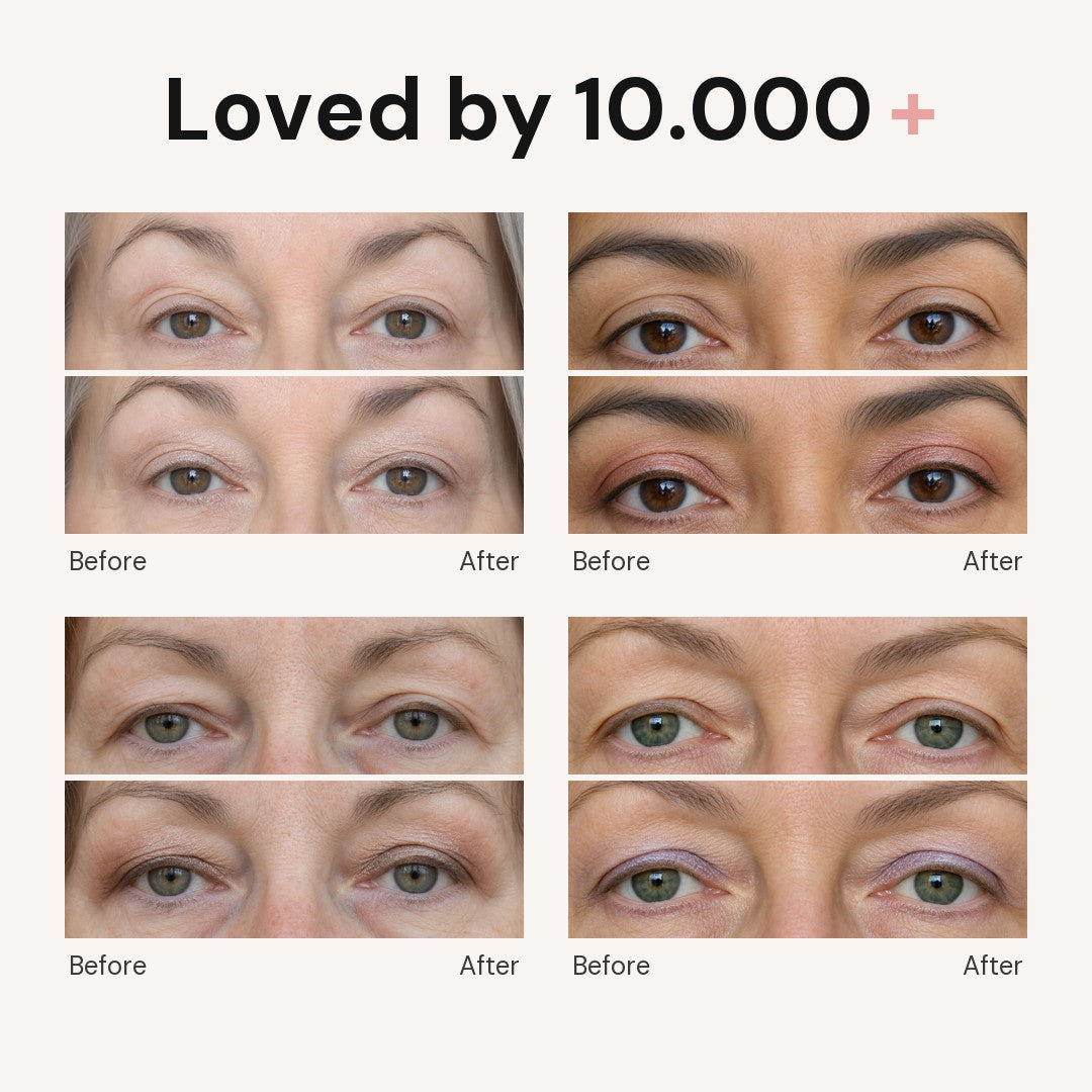 Loved by 10.000+ — before and after on four women