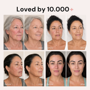 Korean Blemish Balm loved by grid before and after