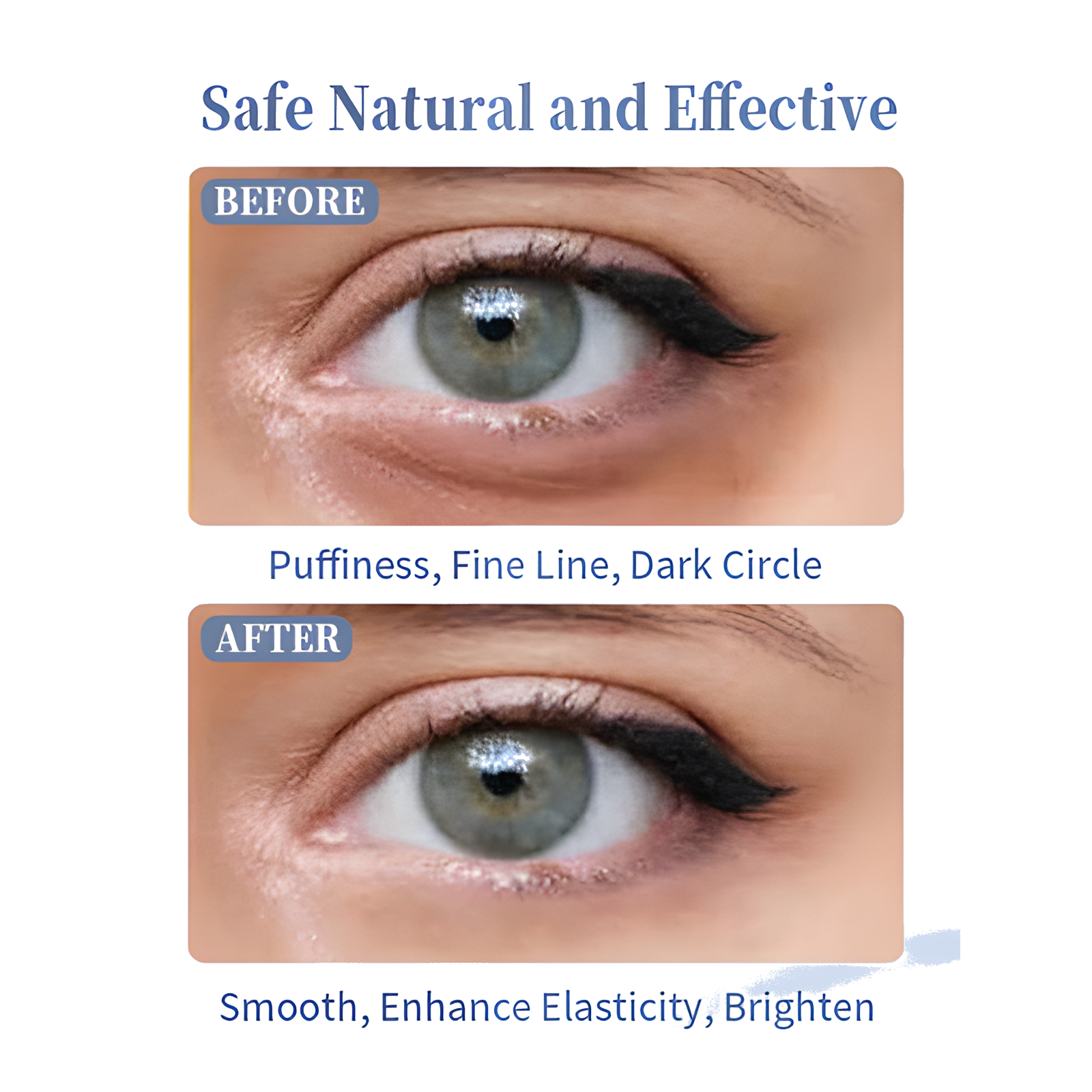 Under-eye before and after using the eye roller