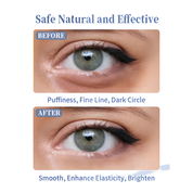 Under-eye before and after using the eye roller