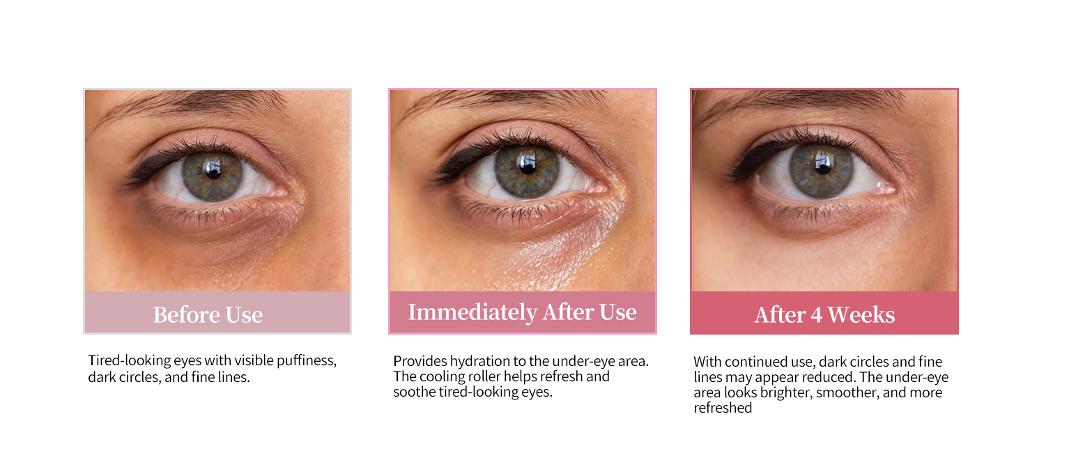 Eye roller results over time