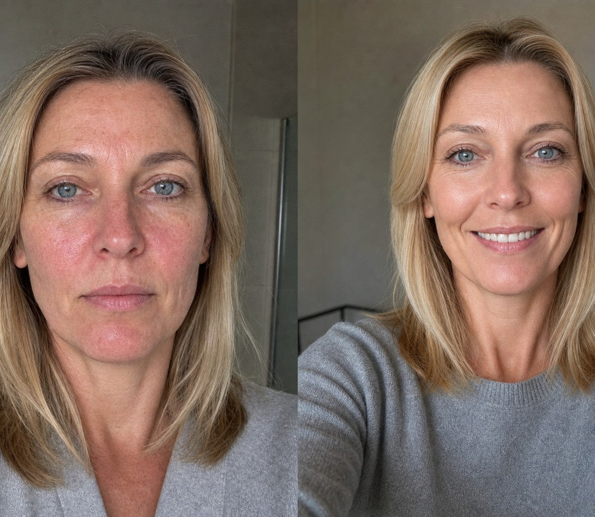 Samantha before and after