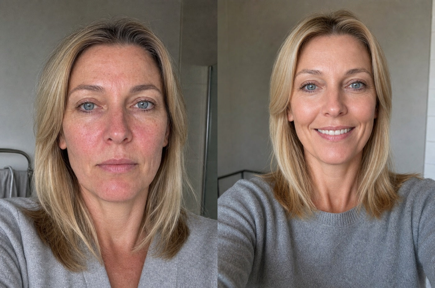 Before and after on mature skin