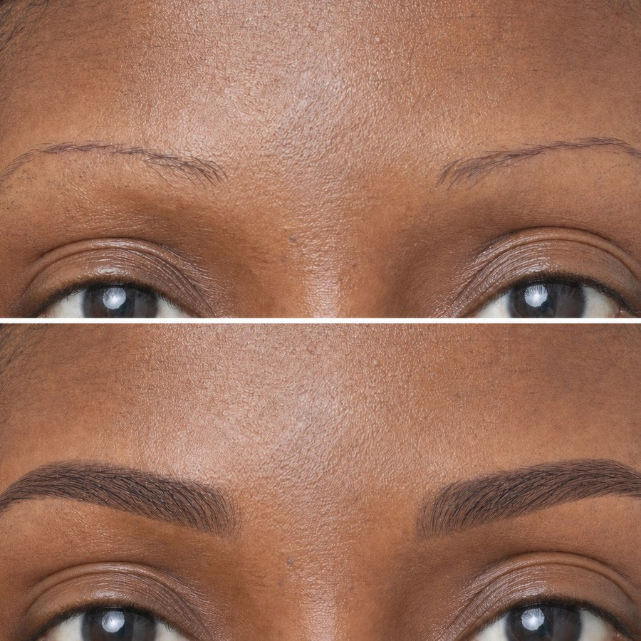 Priti before and after